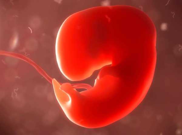 Matar no es un derecho