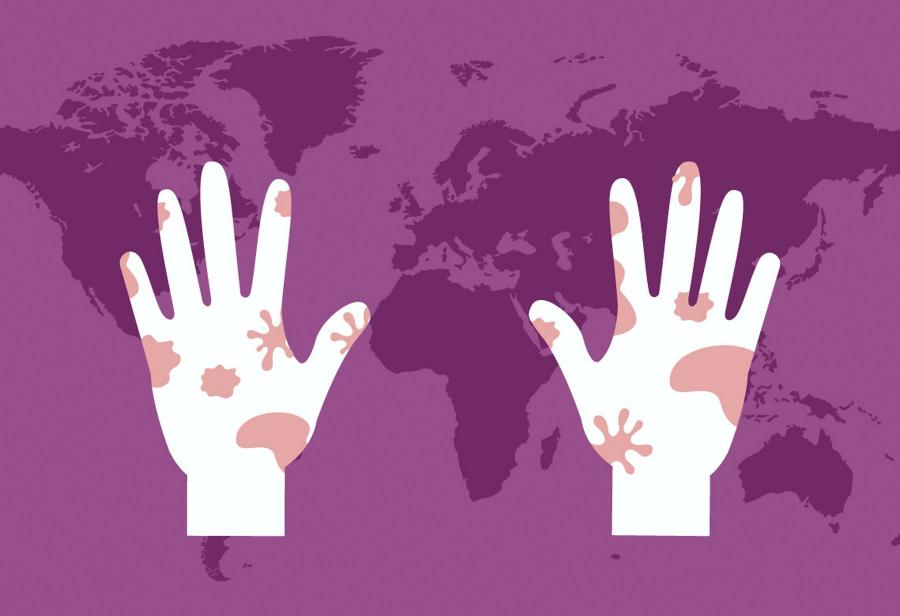 D&iacute;a Mundial de la Lepra